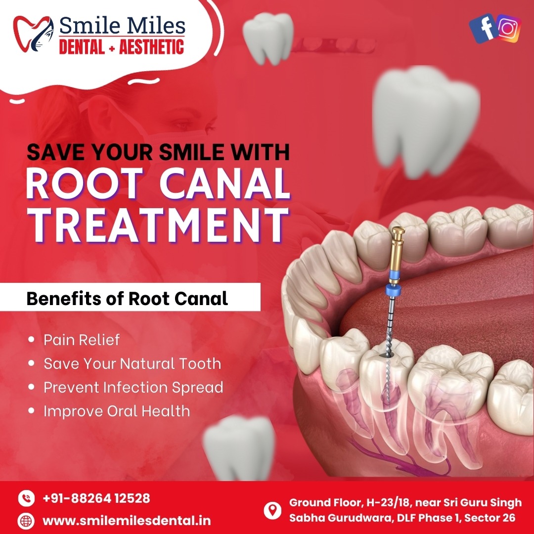 Painless RCT